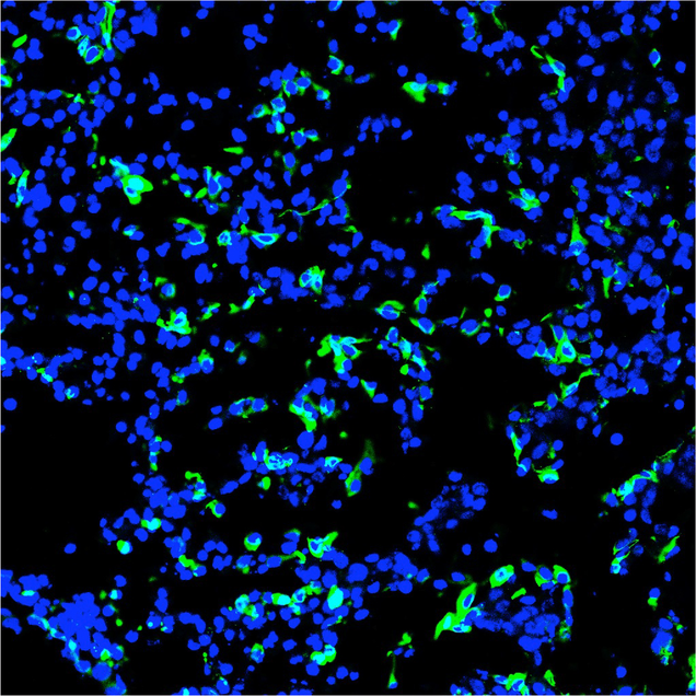 “Human cells (green) were found in a section of 4-week-old pig embryo. Blue color (DNA) indicates both pig and human cells.” Image: Jun Wu